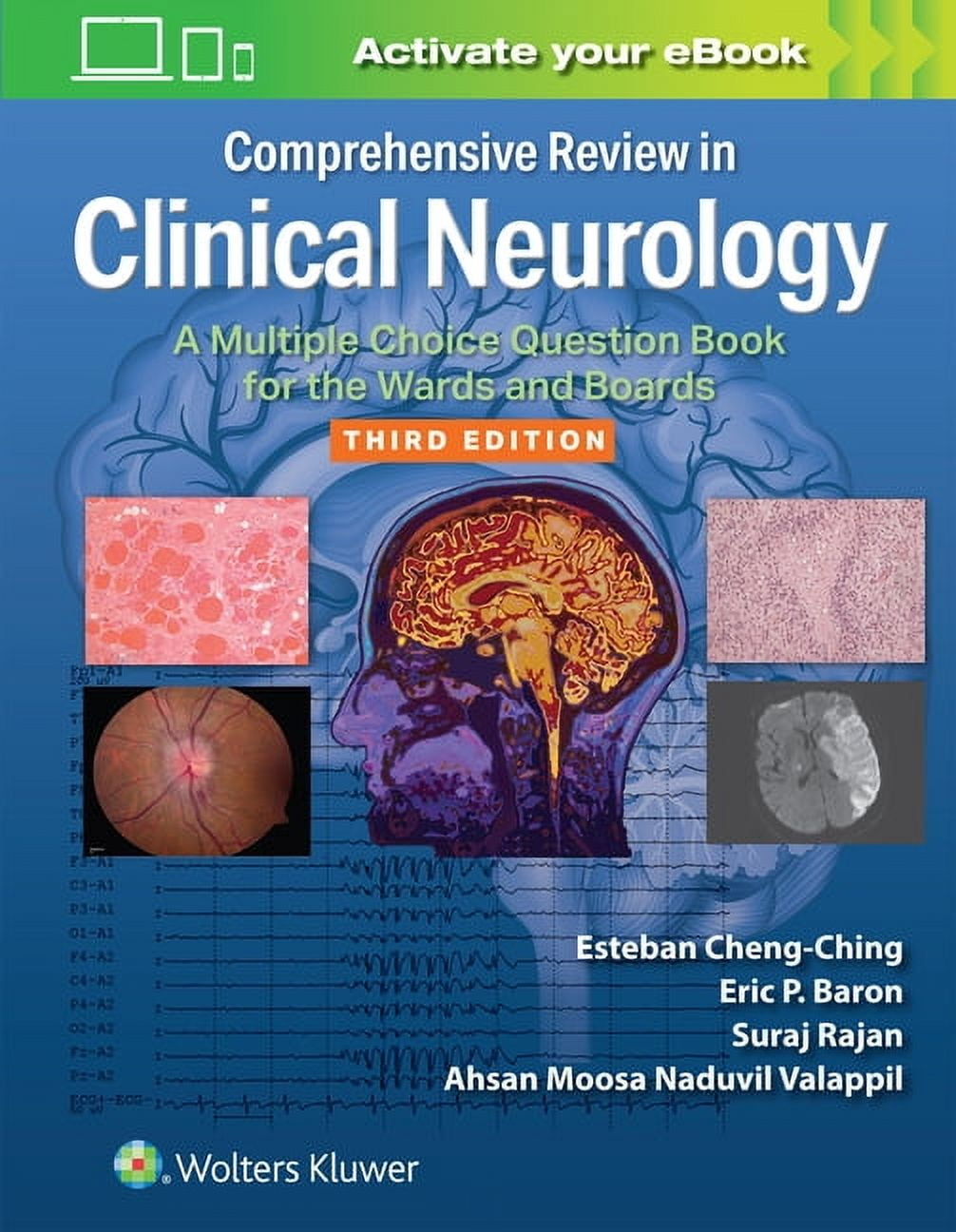 Comprehensive Review in Clinical Neurology: A Multiple