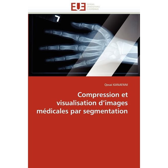 Omn.Univ.Europ.: Compression Et Visualisation D Images Mdicales Par Segmentation (Paperback)