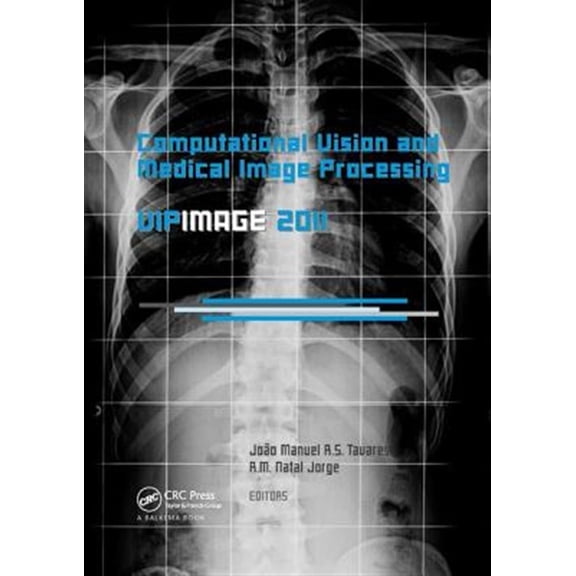Pre-Owned Computational Vision and Medical Image Processing: VipIMAGE 2011, (Paperback)