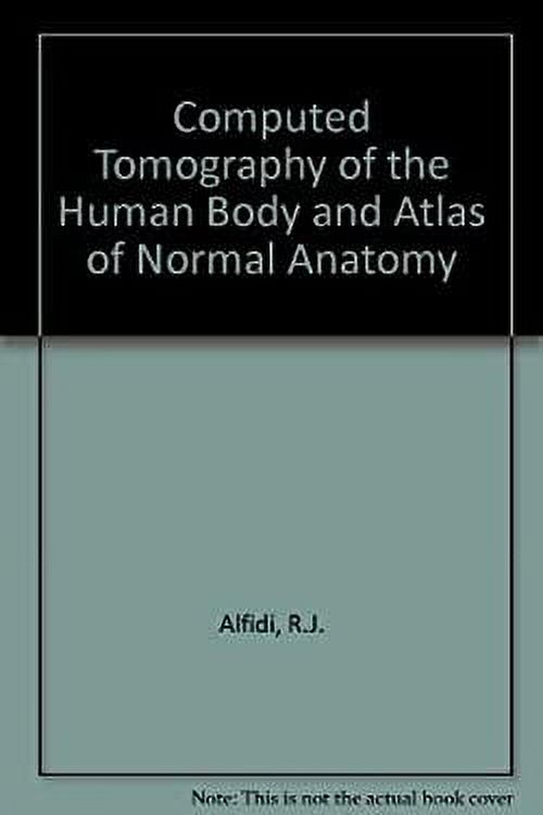 Pre-Owned Computed Tomography of the Human Body : An Atlas of Normal ...
