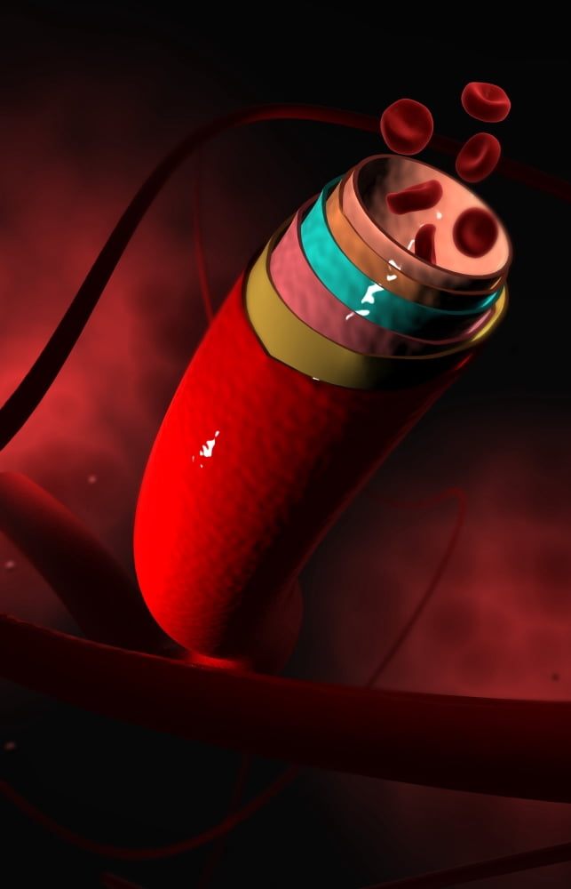 Conceptual image of a blood vessel Canvas Art - Stocktrek Images (12 x 18)