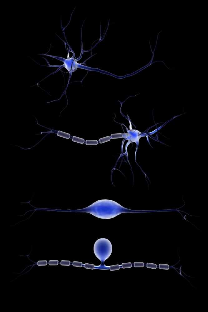 Conceptual image of a neuron Canvas Art - Stocktrek Images (12 x 18)