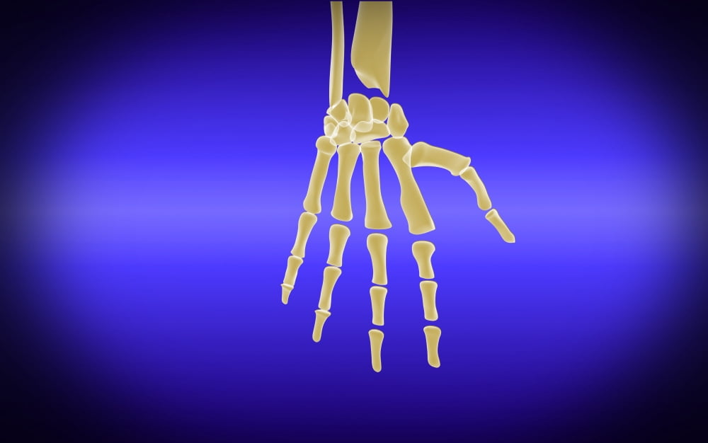 Conceptual image of bones in human hand Canvas Art - Stocktrek Images (18 x 12)