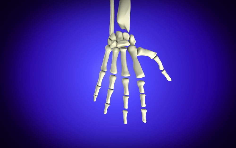 Conceptual image of bones in human hand Canvas Art - Stocktrek Images (36 x 23)