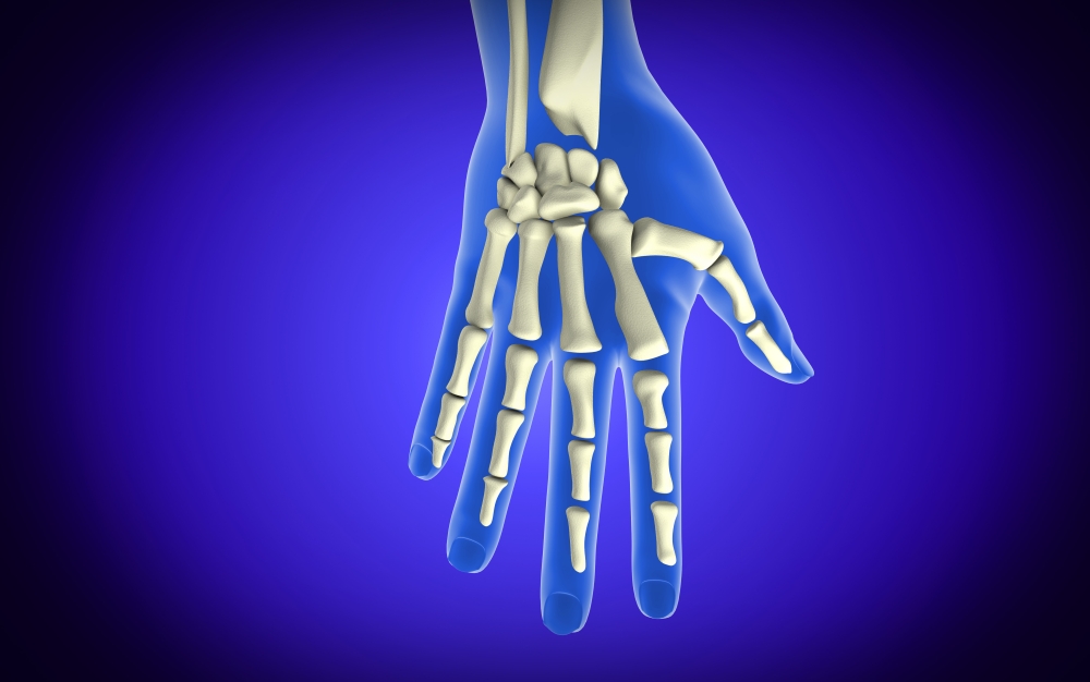 Conceptual image of bones in human hand Canvas Art - Stocktrek Images (36 x 23)