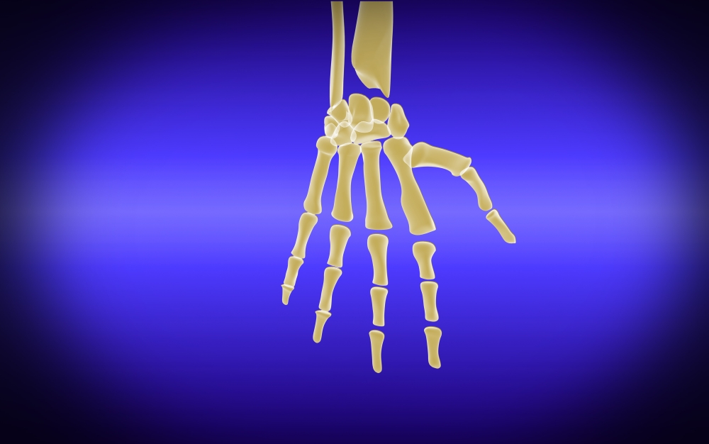 Conceptual image of bones in human hand Canvas Art - Stocktrek Images (36 x 23)