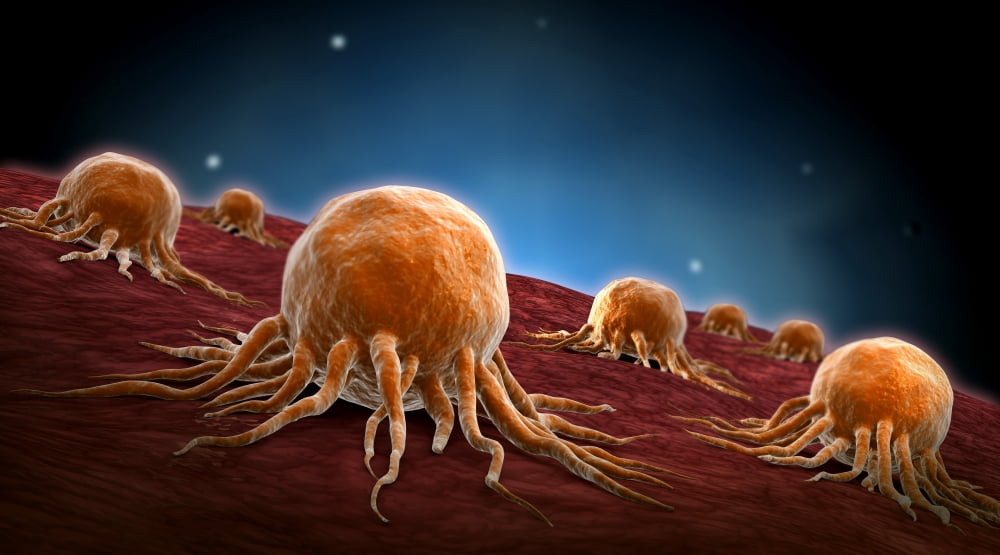 Conceptual image of cancer virus Canvas Art - Stocktrek Images (19 x 11)