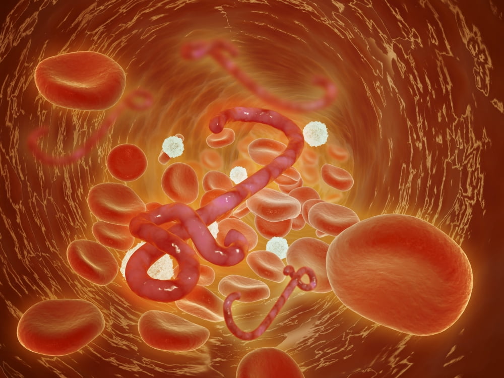 Conceptual image of ebola virus in artery Canvas Art - Stocktrek Images (33 x 25)