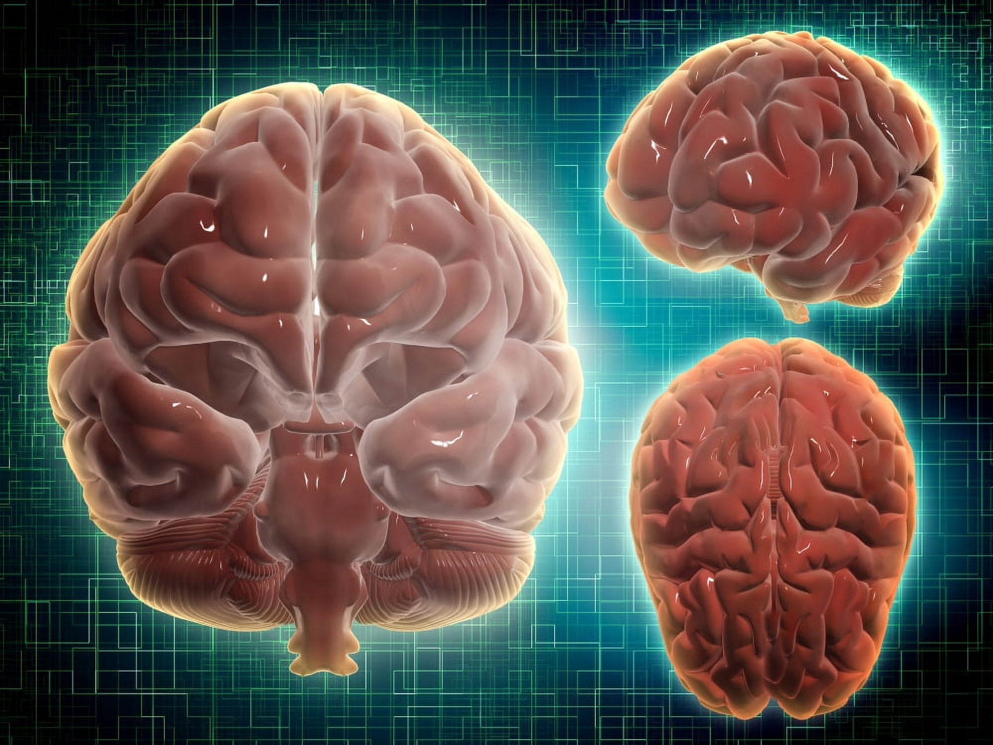 Conceptual image of human brain at different angles Canvas Art - Stocktrek Images (17 x 13)