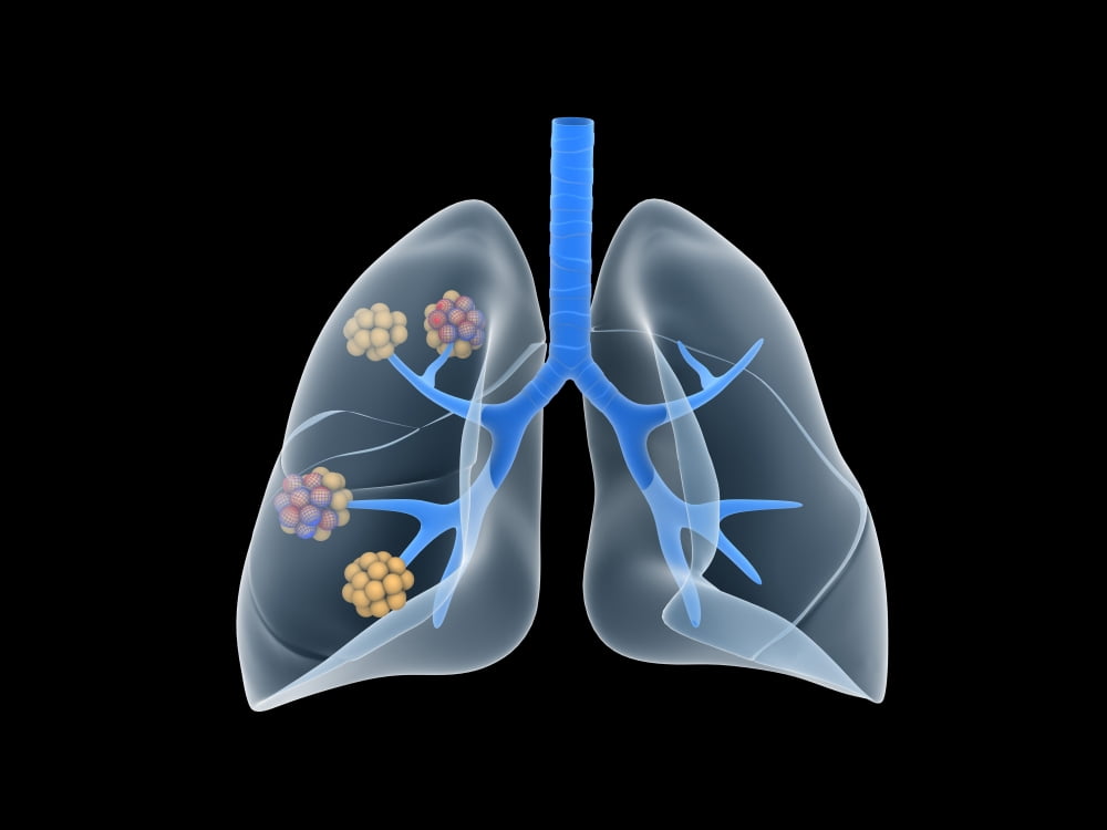Conceptual image of human lungs Canvas Art - Stocktrek Images (17 x 13)