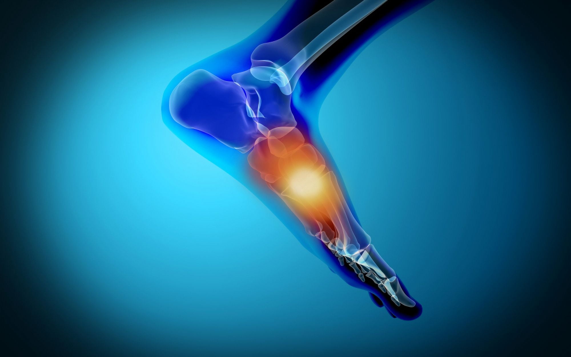 Conceptual image of pain in human foot Canvas Art - Stocktrek Images (36 x 23)