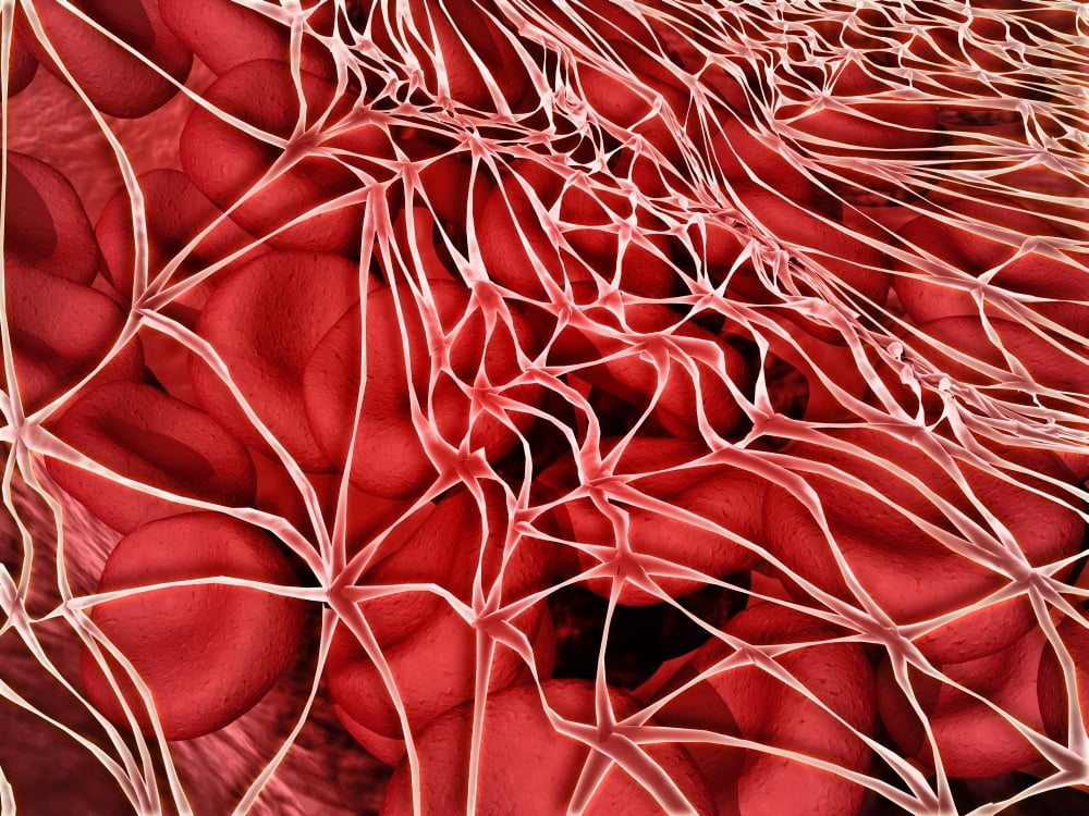 Conceptual image of red blood cells with fibrin Canvas Art - Stocktrek Images (17 x 13)