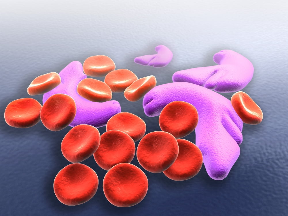 Conceptual image of sickle cell anemia Canvas Art - Stocktrek Images (17 x 13)