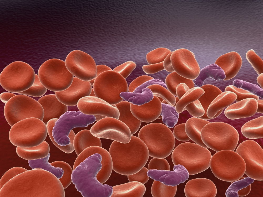 Conceptual image of sickle cell anemia with red blood cells Canvas Art - Stocktrek Images (17 x 13)