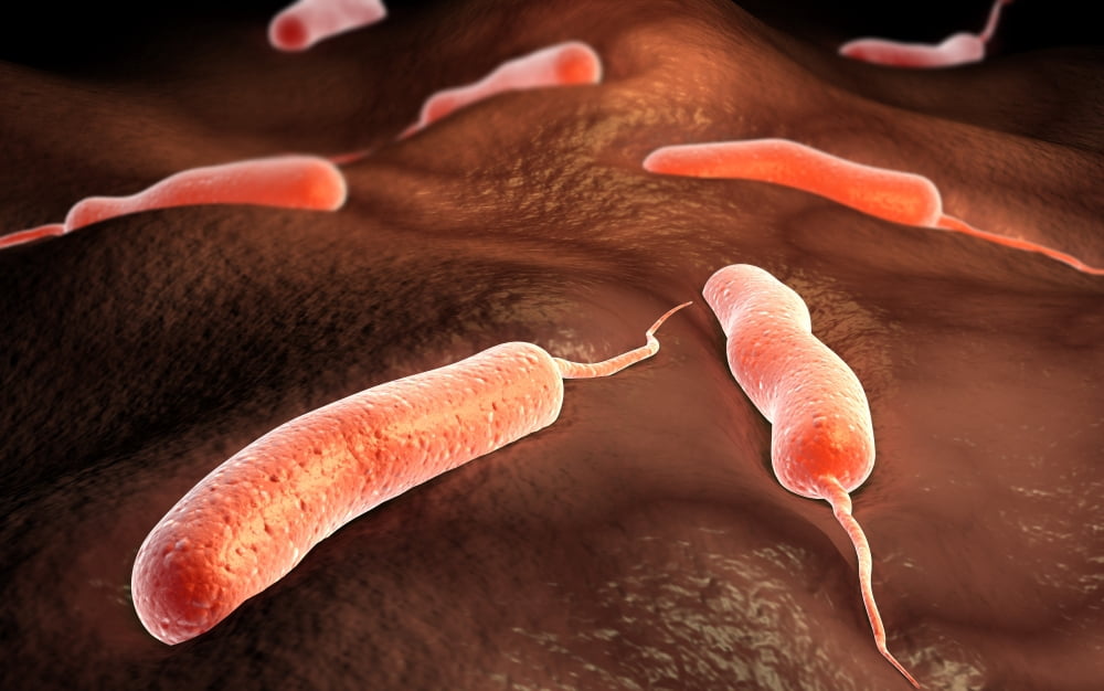 Conceptual image of vibrio cholerae causing cholera Canvas Art - Stocktrek Images (18 x 12)