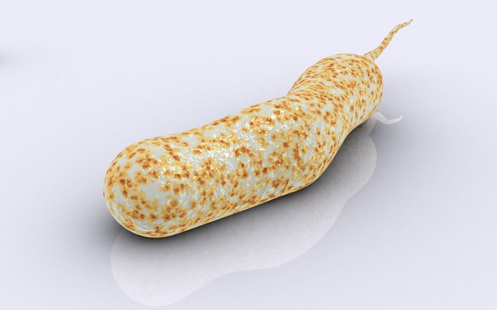Conceptual image of vibrio cholerae causing cholera Canvas Art - Stocktrek Images (36 x 23)