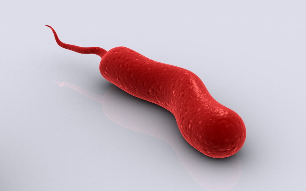 Conceptual image of vibrio cholerae causing cholera Canvas Art - Stocktrek Images (36 x 23)