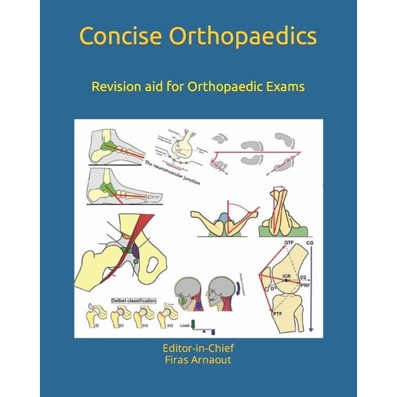 Concise Orthopaedics Concise Orthopaedic Notes: Revision aid for FRCS, EBOT , SICOT and Board Examinations, (Paperback)