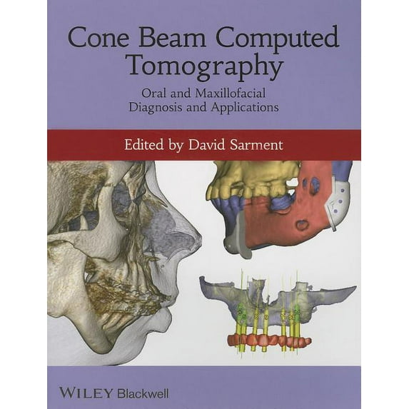 Cone Beam Computed Tomography: Oral and Maxillofacial Diagnosis and Applications, (Paperback)