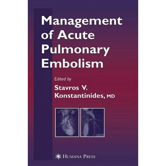 Contemporary Cardiology Management of Acute Pulmonary Embolism, (Hardcover)