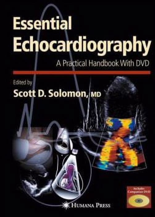 Contemporary Cardiology (eBook): Essential Echocardiography: A Practical Handbook with DVD (eBook)
