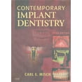 thumbnail image 1 of Contemporary Implant Dentistry (Hardcover) by Carl E Misch, 1 of 1