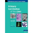 thumbnail image 1 of Contemporary Issues in Cancer Imaging Primary Carcinomas of the Liver, (Hardcover), 1 of 1