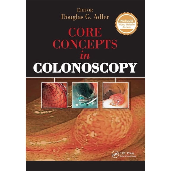 Core Concepts in Colonoscopy, (Paperback)