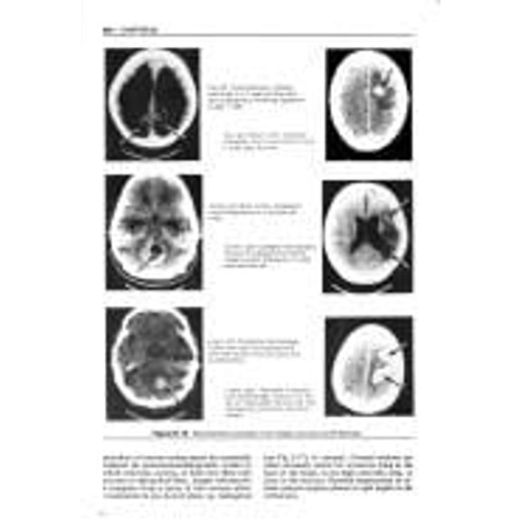 Pre-Owned Correlative Neuroanatomy 21th Edition Paperback