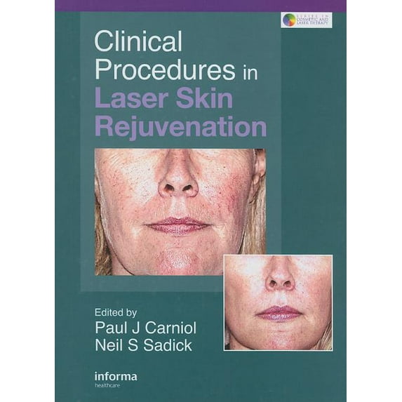 Cosmetic and Laser Therapy Clinical Procedures in Laser Skin Rejuvenation, (Hardcover)