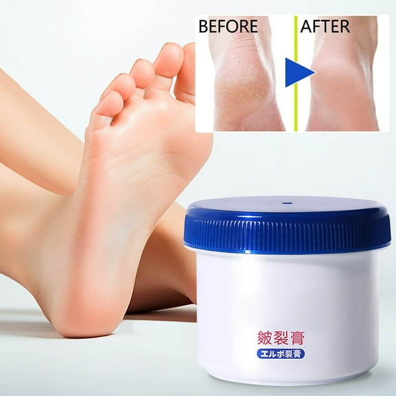 Costeam Anti Chapping Balm Intensive Hydration Formula Repairs Severe Cracked and Rough Skin for Long Lasting Moisture