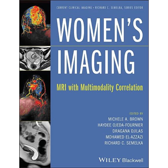 Current Clinical Imaging: Women's Imaging: MRI with Multimodality Correlation (Hardcover)