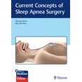 thumbnail image 1 of Current Concepts of Sleep Apnea Surgery, (Hardcover), 1 of 1
