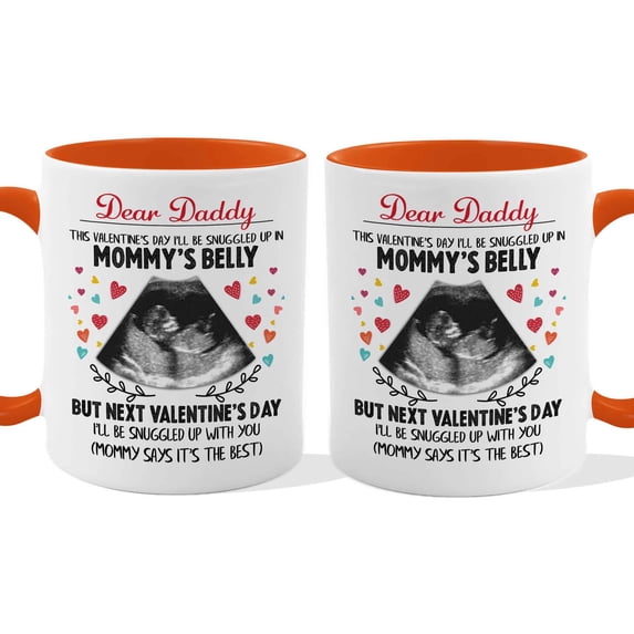 Customizaholic Personalized Pregnancy Announcement Mug - Ultrasound Design, Custom Message Keepsake Gift for Dad