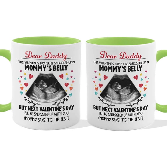 Customizaholic Personalized Pregnancy Announcement Mug - Ultrasound Design, Custom Message Keepsake Gift for Dad