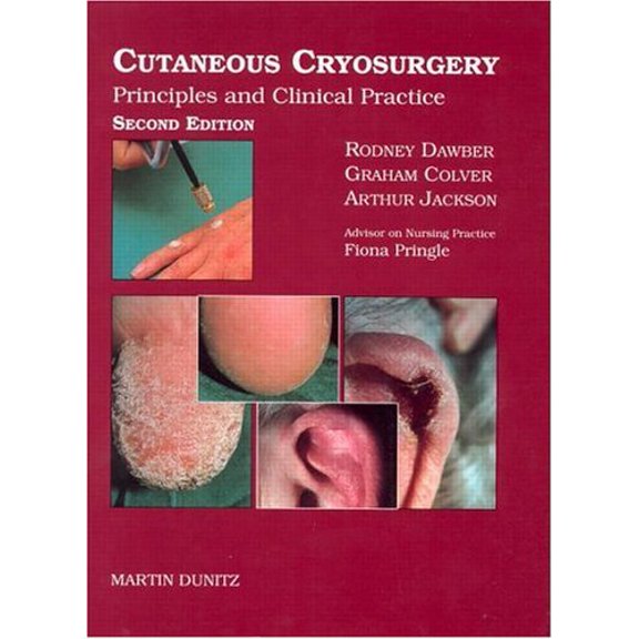 Pre-Owned Cutaneous Cryosurgery: Principles and Clinical Practice (Hardcover) 1853174300 9781853174308