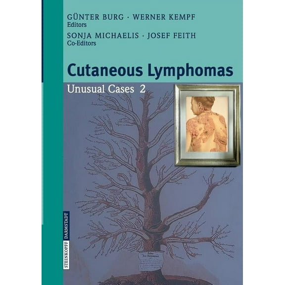 Cutaneous Lymphomas: Unusual Cases 2, (Paperback)