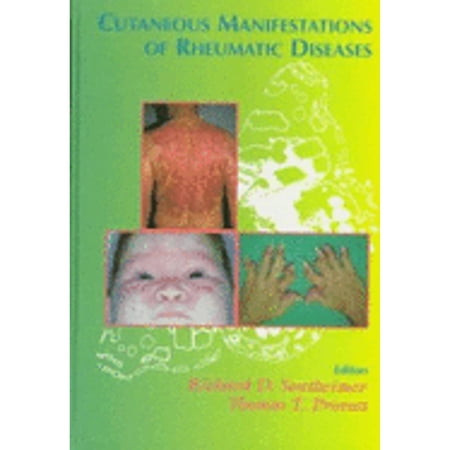 Cutaneous Manifestations of Rheumatic Diseases by Richard D. Sontheimer (Hardcover)