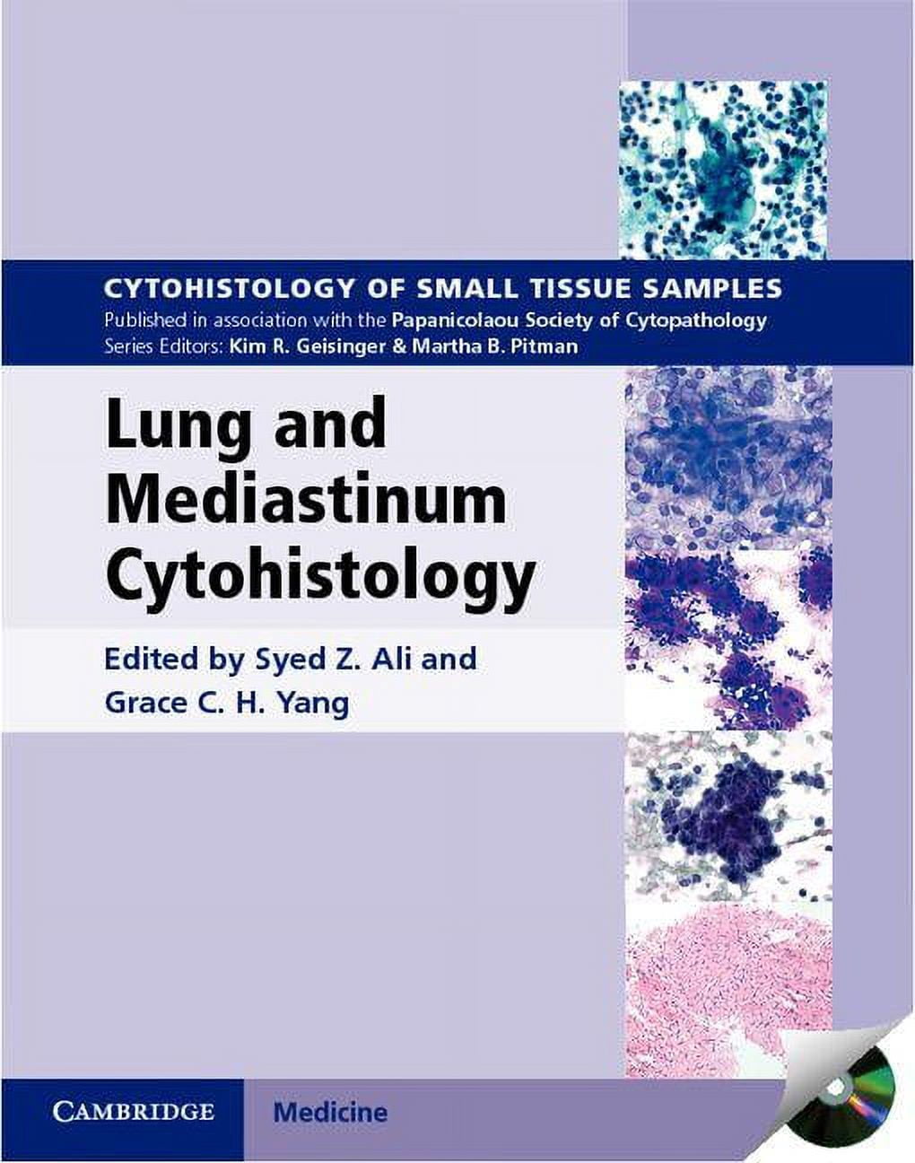 Small Tissue Sample Cytohistology of Small Tissue Samples Lung and Mediastinum ...