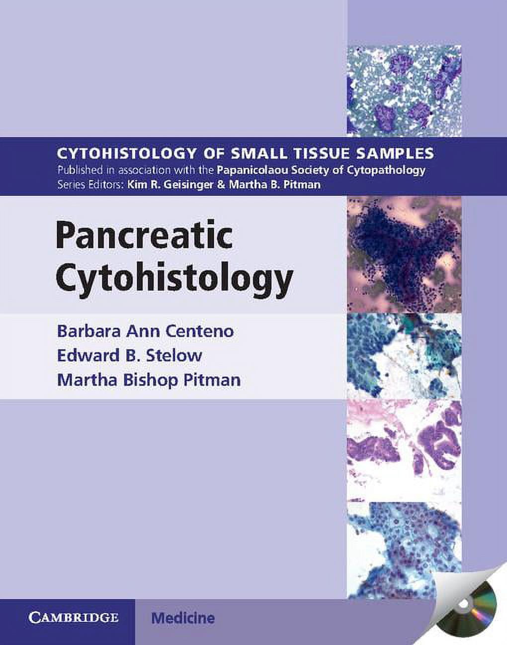 Small Tissue Sample Cytohistology of Small Tissue Samples Pancreatic Cytohistology ...