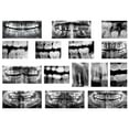 thumbnail image 1 of DENTAL XRAYS, 1 of 5