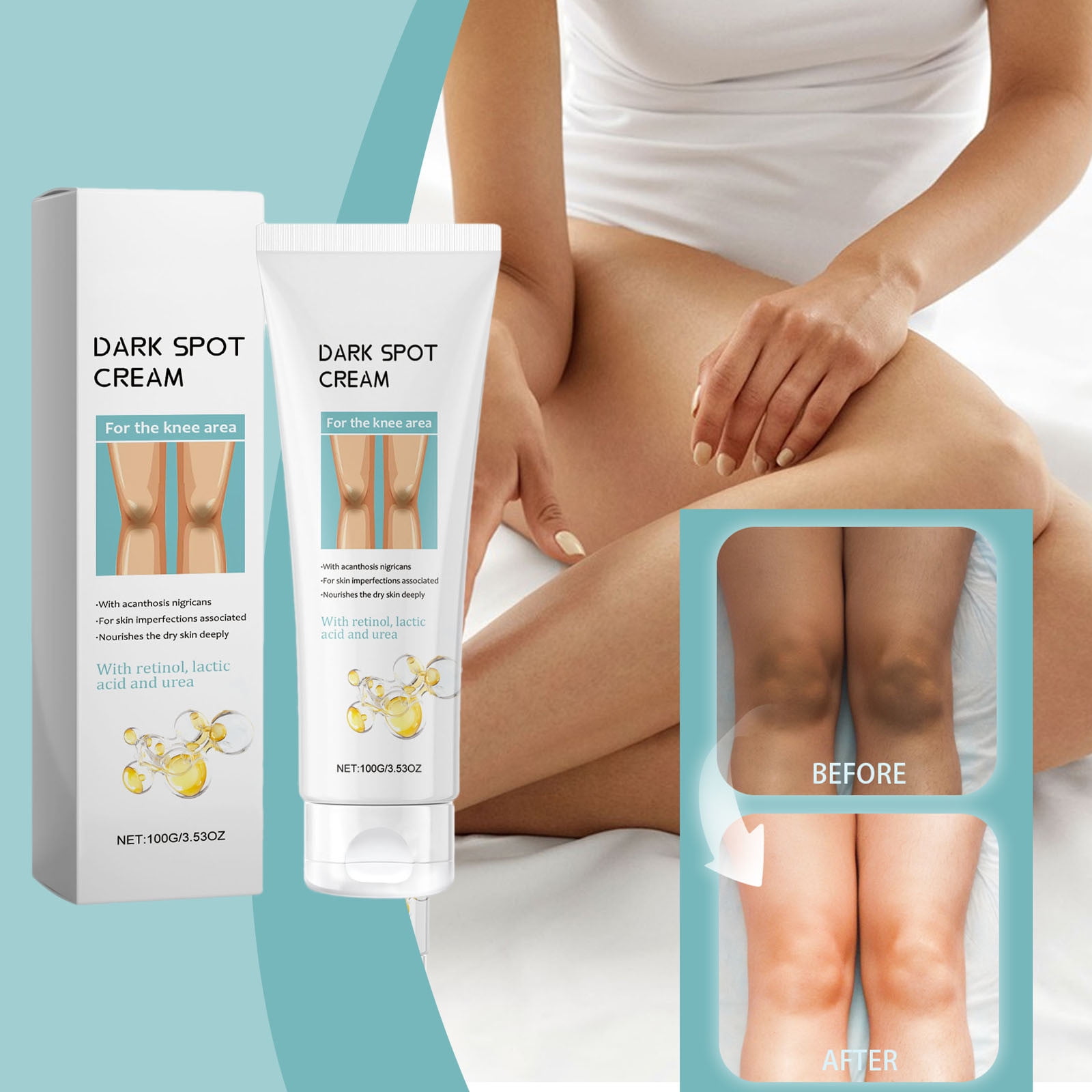 DIURYCE 2024 Moisturizing Skin Care Daily Body Lotion Knee Frost