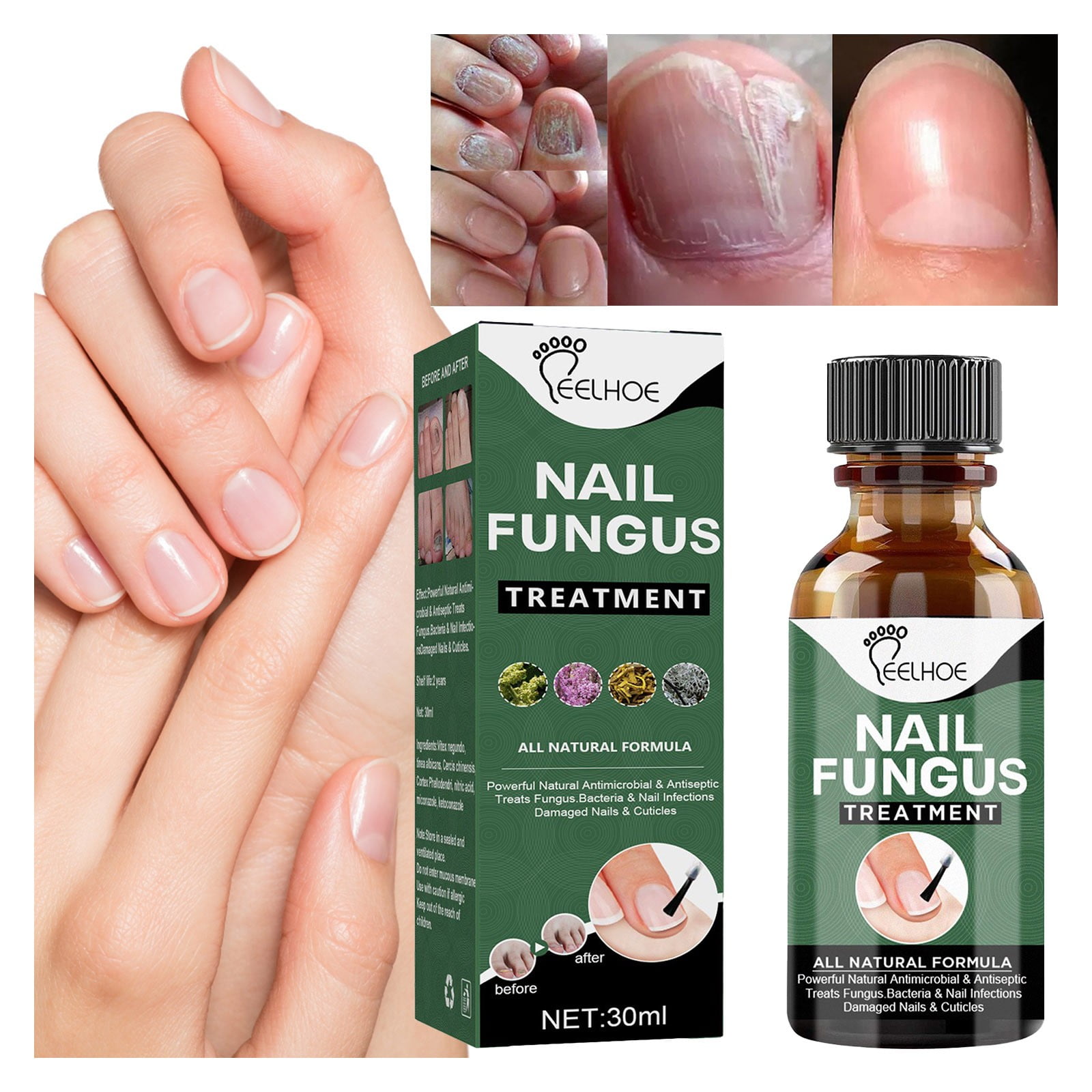 DIY nail care tricks Nail care for brittle nails Nail care routine