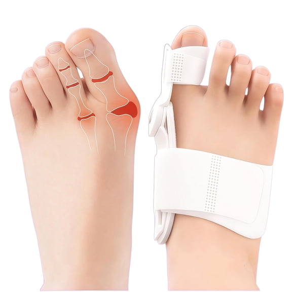DUPAI Bunion Corrector for Men&Women,Orthopedic Hallux Valgus Corrector with Rigid Re Support&Adjustable Strap,Big Toe Separators Straightener for Bunion Pain Relief,Day Night Support 1