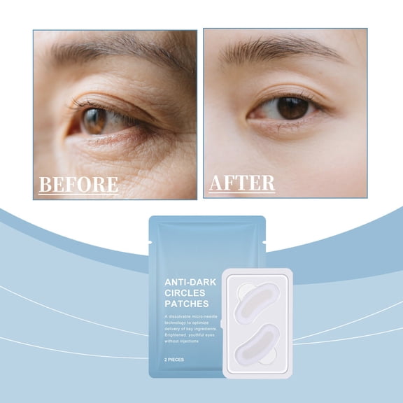 Dark Circles Eye Patch With Hyaluronic Microneedles Moisturize And The Eyes Lock The Water Moisturize And The Eyes And Continue To Moisturize And The Eyes 5ml