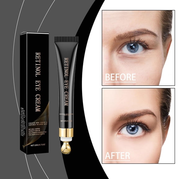 Dark Circles Under Eye Treatment,Eye Cream for Puffiness and Bags Under Eyes,Intensive Eye Repair Cream 20g - Eliminates Eye Bags & Wrinkles, Brightens Eyes(MulticolorBlack)