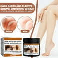 thumbnail image 1 of Dark Elbow and Knees Remover Cream, Skin VVhitening Cream for Dark Inner Thigh, Underarms, Armpit, Neck, Knuckles, Private Parts and Toes, Improve Private Area Odor, Quick Results, 1 of 9