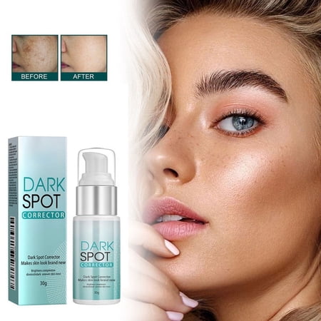Dark Spot Correcting Cream for Moisturizing & Brightening Skin,Skin Correction Cream,Black Spot Fading Cream for Nourishing,Suitable for All Skin Types and Tones,1PCS