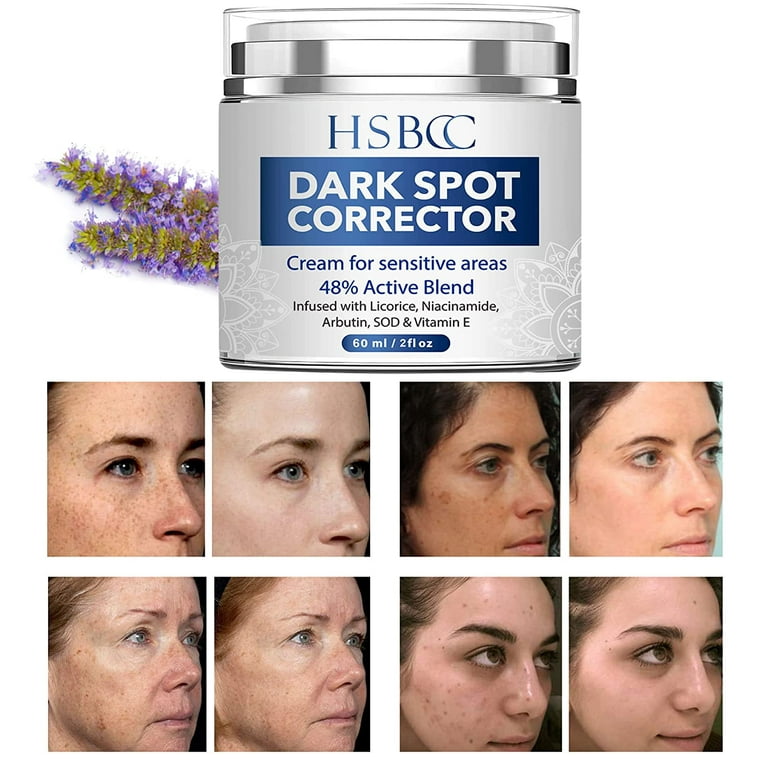 Dark Spot Remover for Face, Sun Spots Melasma Freckle Remover, Formulated with Arbutin, Niacinamide & Vitamin E-2 Fl Oz - Walmart.com