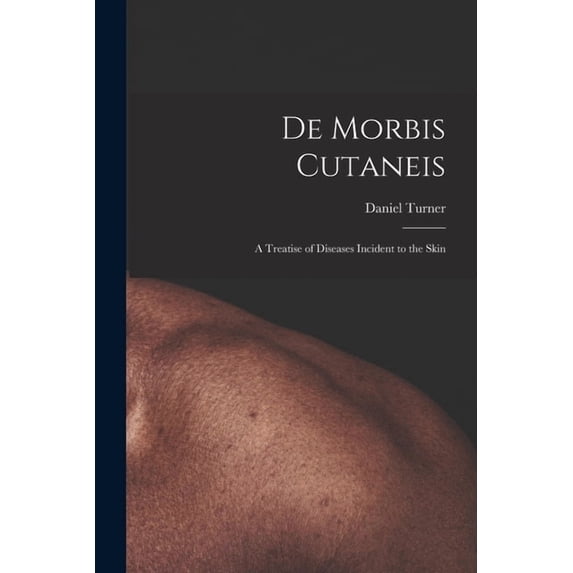 De Morbis Cutaneis: a Treatise of Diseases Incident to the Skin Paperback 1013741536 9781013741531 Daniel 1667-1741 Turner